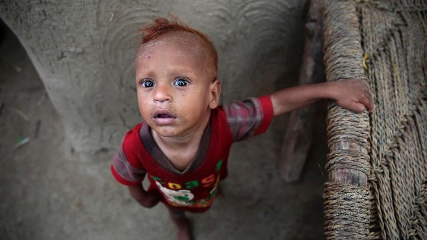 In this photo taken on Friday, Oct. 7, 2016, a boy stands in front of his family's hut at a camp for internally displaced people near the town of Abs, located on Yemen’s western coastal plain below towering desert mountains. Hundreds of Yemenis fleeing war are now living in tents and mud-brick shelters scattered across a cornfield, where they buried the remains of loved ones they carried with them when they escaped. (AP Photos Hani Mohammed)